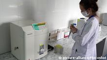 Коронавірус в Україні: за добу виявили 2106 нових випадків