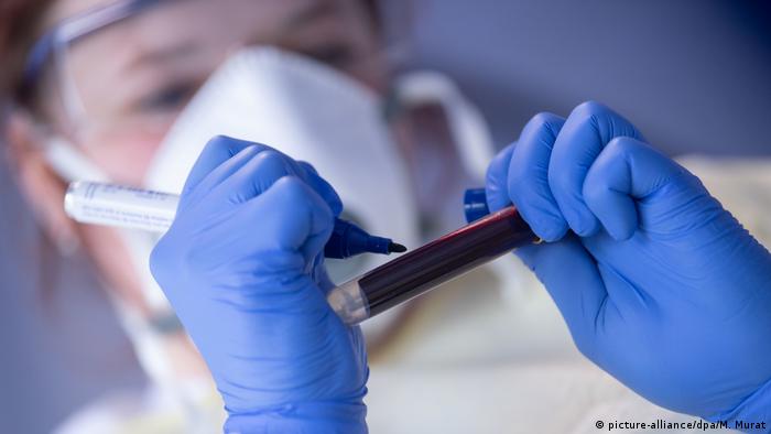 Wort des Jahres 2020: Corona-Pandemie; eine Mitarbeiterin des Robert Koch-Instituts (RKI) beschriftet eine Blutprobe für einen Antikörpertest - sie trägt Handschuhe, Brille und Mundschutz