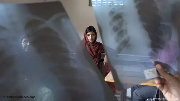 Indisches Mädchen nach überstandener Tuberkulose-Therapie, im Vordergrund werden Röntgenbilder einer Lunge hochgehalten (Foto: dpa)