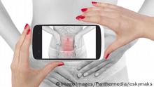Intestine pain. Modern high tech medicine. Beautiful woman photography isolated on white background seeing her diagnosis on a smartphone screen. model released Symbolfoto PUBLICATIONxINxGERxSUIxAUTxONLY Copyright: xeskymaksx Panthermedia14407471