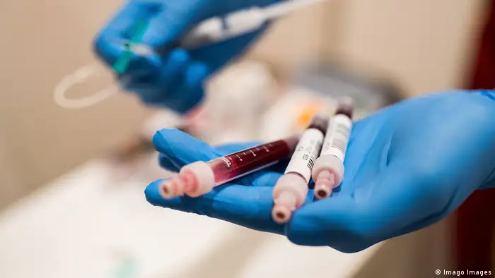 Symbolbild Bluttest Antikörpertest Test Coronavirus (Imago Images)