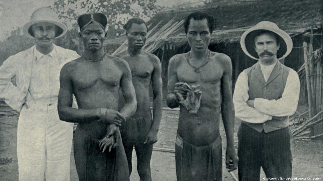 Two men hold the severed hands of their countrymen who were murdered by rubber sentries in 1904 in DR.