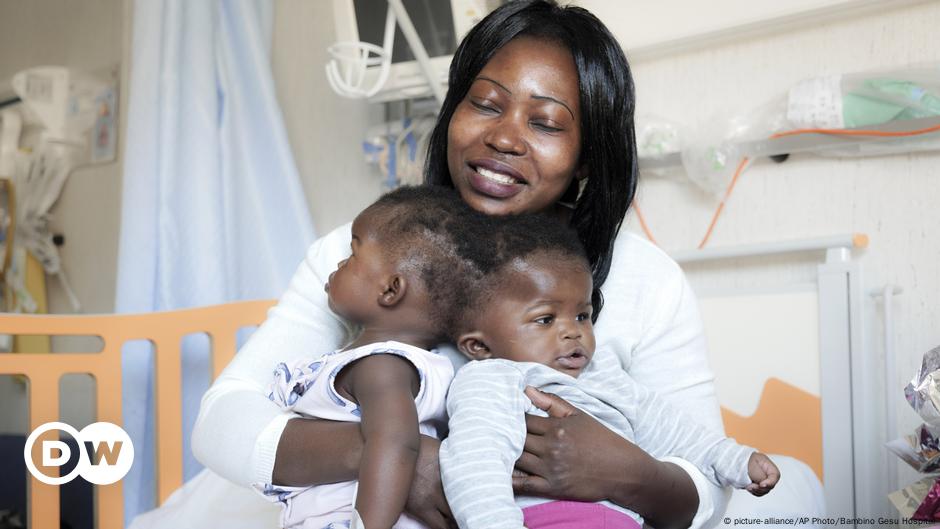 Doctors Separate Conjoined Twins In Rare Surgery Dw 07082020 6169