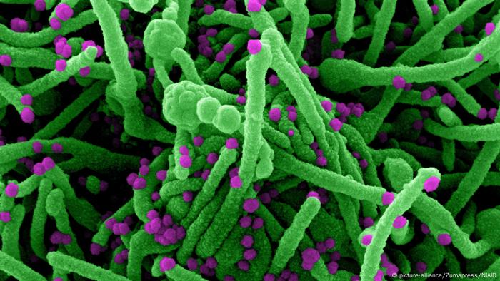  Coronavirus: imagen en color bajo el microscopio electrónico