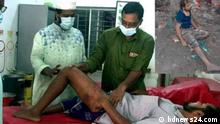 Amir Hossain of Laxmipur district of Bangladesh is receiving medical treatment after he was allegedly beaten by the men of local Chairman.
