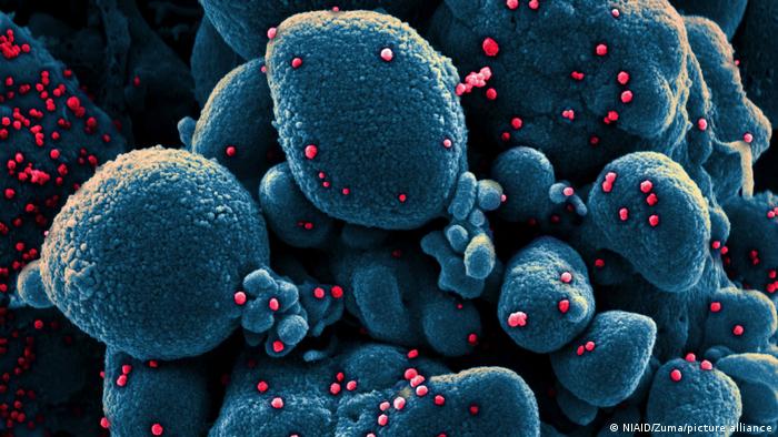 Sel yang terinfeksi SARS-Cov-2 dalam gambar mikroskop elektron