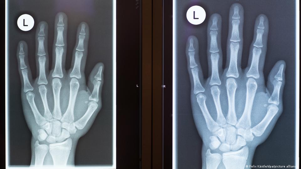 Как делают рентген детям, с какого возраста и вреден ли он?