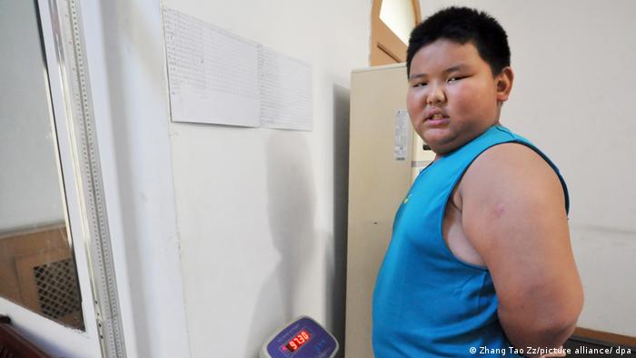 Übergewichtiger asiatischer Junge steht auf einer Waage und schaut seitlich in die Kamera