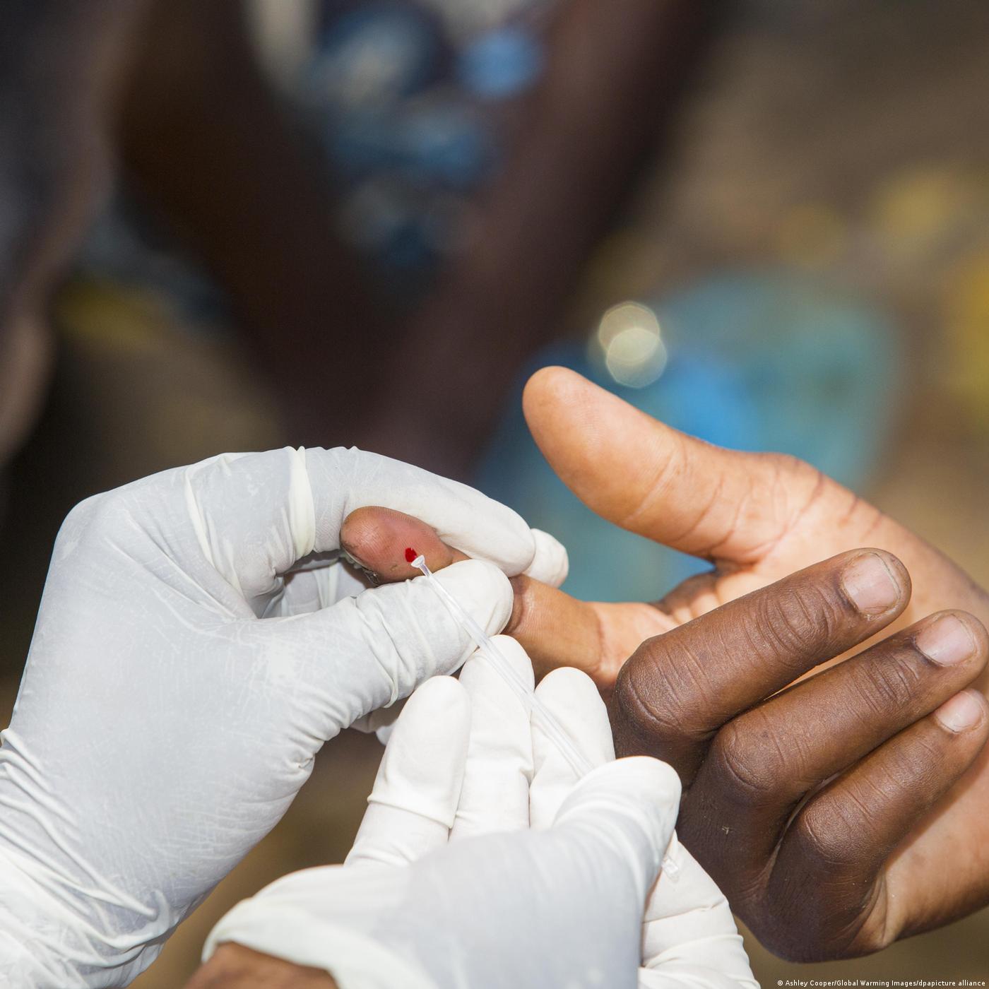 L'hémophilie, une maladie invalidante