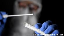 Омікрон-варіант коронавірусу загрожує критичній інфраструктурі Німеччини