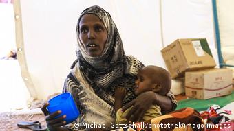 Υποσιτισμένη γυναίκα στην Αιθιοπία 