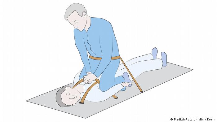 Illustration for cardiopulmonary resuscitation (CPR) during spaceflight, courtesy of Prof. Jochen Hinkelbein. This shows the waist straddle method.
