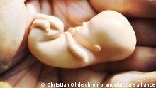 Закон про аборти в Польщі: прокуратура розслідує смерть вагітної жінки