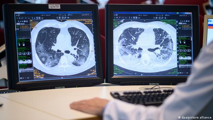 Ein Arzt, der ein Bild der Lungen eines Cov-Patienten betrachtet