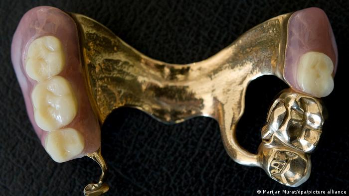 Gold teeth shown in a model mouth