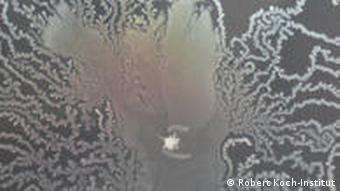 Erreger auf einem Nährboden (Foto: Robert Koch Institut)