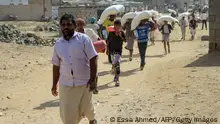 الأمم المتحدة: الحرب تترك 80 بالمائة من اليمنيين بلا طعام!