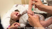 La OMS dice que atender hepatitis infantil aguda es muy urgente
