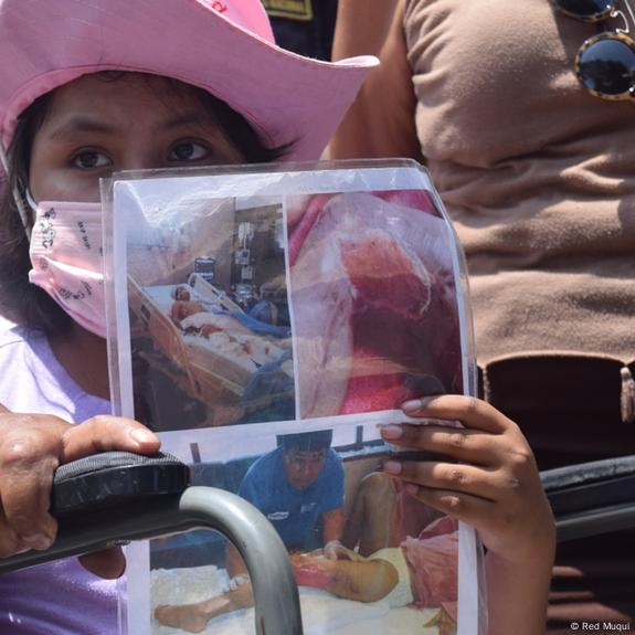 ¿La visión de los niños empeora La contaminación del aire puede ser la culpable – Infobae