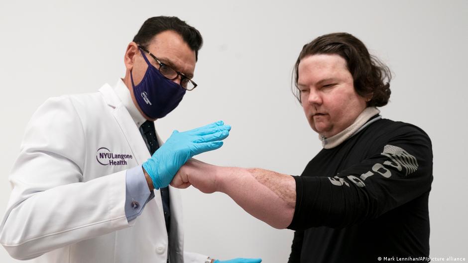Joe DiMeo: Unprecedent transplant ′a second chance at life′ | Science| In-depth reporting on science and technology | DW - Vimarsana News