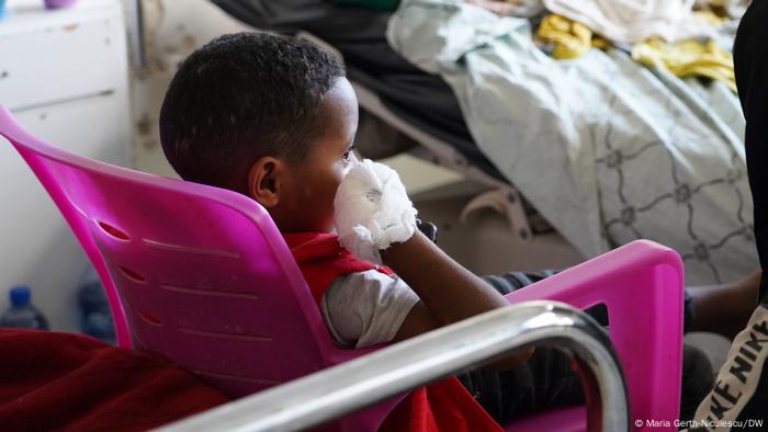 A young child with an amputated arm sits on a chair.