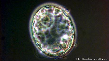 A human blastocyst created at the Centre for Life in the north England city of Newcastle by scientists Dr. Miodrag Stojkovic and Prof. Alison Murdoch and announced by them Thursday, 19 May 2005. It is the first to be created in Britain and the first to be grown in the western world. 