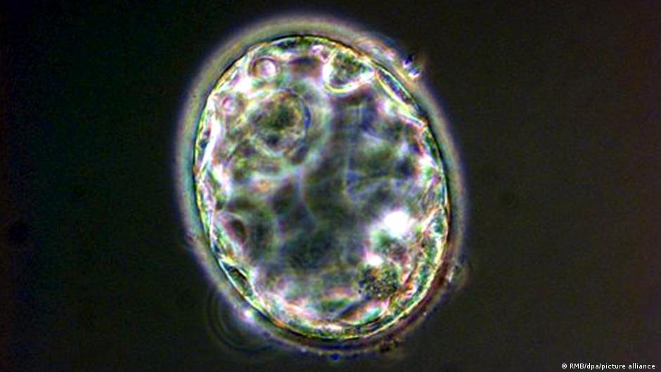 Scientists create first complete human embryo model in Petri dish | Science| In-depth reporting on science and technology | DW - Vimarsana News