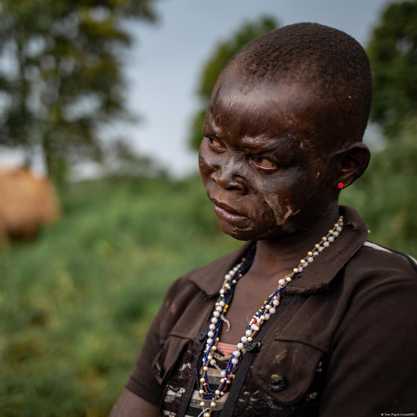 Ces victimes de conflits qu'on oublie