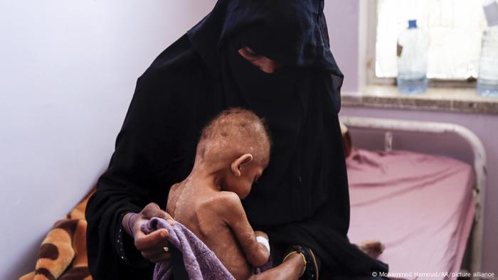 A mother and a starving toddler at a hospital. 