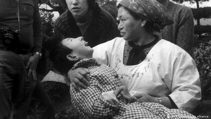 A woman holds a girl with a malformed hand, who was a victim of the mercury poisoning