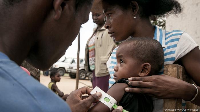 Arm of baby is measured in Madagascar