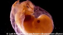 Human Embryo (Homo sapiens)