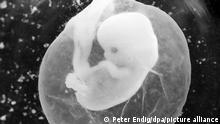 Un feto de siete semanas en un saco amniótico. 