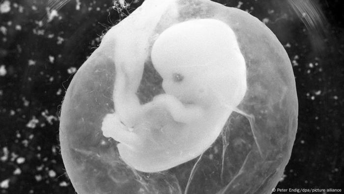 Un feto de siete semanas en un saco amniótico.