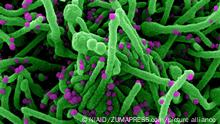 Micrografía electrónica de barrido coloreada de una célula (verde) infectada con partículas del virus SARS-CoV-2 (púrpura), aislada de una muestra de un paciente.