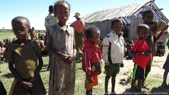 Mangelernährte Kinder in Madagaskar 