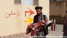 An Afghan civilian carry a wounded child to the hospital after he was injured during fighting between Taliban and government in Badghis province, northwest of Afghanistan, Wednesday, July,7 2021. From the early hours of Wednesday morning, battles have raged near the provincial police headquarters and a Qala-e-Naw army base, said Abdul Aziz beg, head of the provincial council in Badghis. (AP Photo/ Mirwis Omari)
