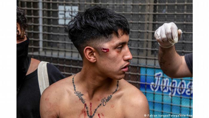 Imagen de Fabian Vargas. Los Carabineros disparaban a propósito a los rostros de los manifestantes.