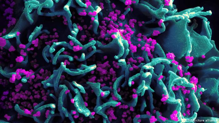 HIV-infizierte Zelle H9 T-cell
