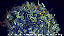 14.01.2014 Scanning electron micrograph of HIV particles infecting a human H9 T cell. PUBLICATIONxINxGERxSUIxAUTxONLY Copyright: NationalxInstitutesxofxHealth/StocktrekxImages NIH700084H