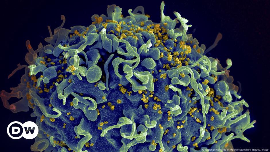 HIV/AIDS need billions in funding to avoid 'deep trouble'