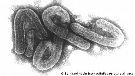 Photo of the Marburg virus