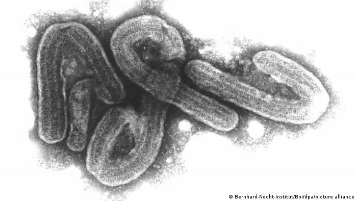 Електронна микроскопска снимка на марбургски вирус