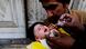 Health workers mark the thumb of a child after giving him the polio vaccine Health workers mark the thumb of a child after giving him the polio vaccine