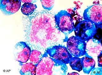 HIV-infizierte Zellen (Quelle: AP)
