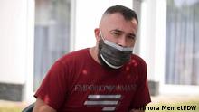 Ibin Emshiu, Überlebender des Brandes im Krankenhaus in Tetovo, Nordmazedonien.
12.09.2021
Tetovo, Nordmazedonien
Arbnora Memeti