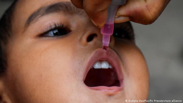 Einem Kind wird eine Schluckimpfung in den Mund getropft