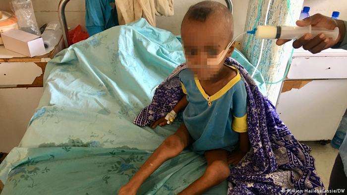 A sick and skinny child sits on a hospital bed in Tigray while receiving medicine