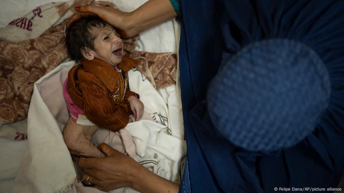 Afghanistan, Kabul | Eine Mutter hält ihr 2 Monate altes Baby im Indira Gandhi Kinderkrankenhaus Afghanistan, Kabul | Eine Mutter hält ihr 2 Monate altes Baby im Indira Gandhi Kinderkrankenhaus