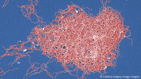 Imagen de laboratorio de la bacteria Borrelia.